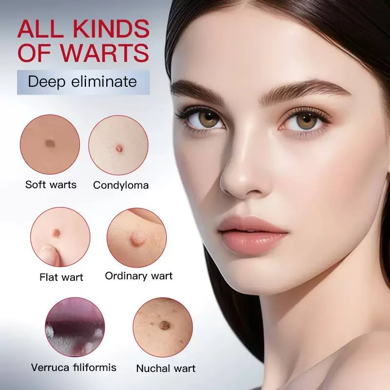 سرم مراقبت موضعی پوست SADOER Tags Wart Remove - تصویر 3