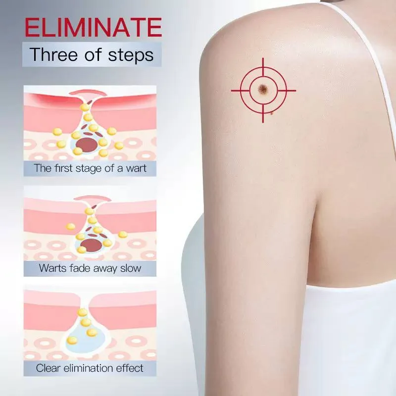 سرم مراقبت موضعی پوست SADOER Tags Wart Remove - تصویر 4