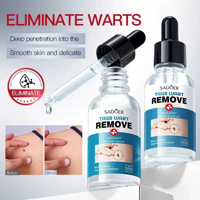 سرم مراقبت موضعی پوست SADOER Tags Wart Remove - تصویر 2