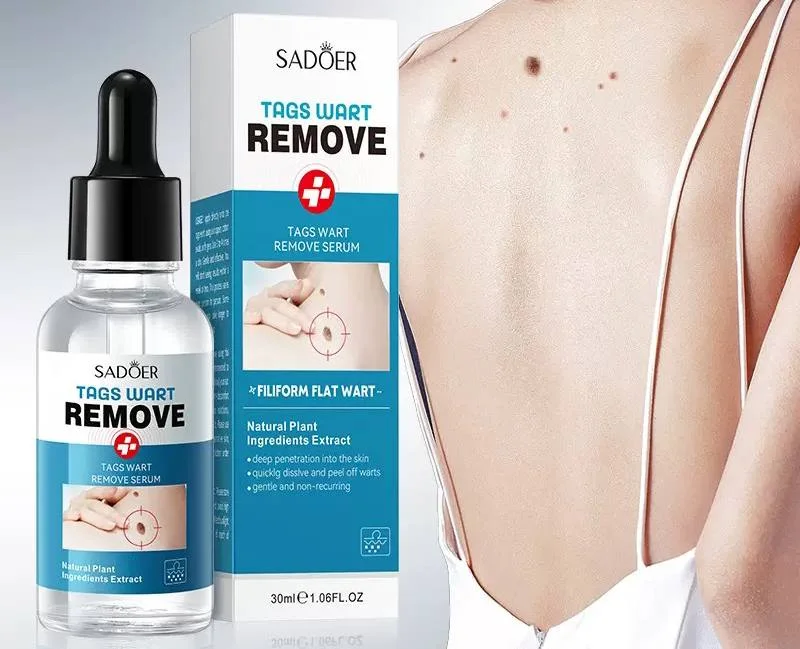 سرم مراقبت موضعی پوست SADOER Tags Wart Remove