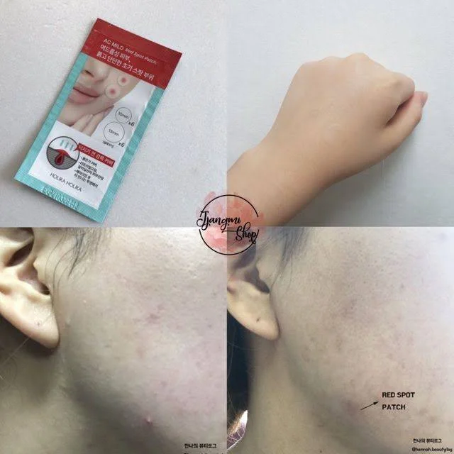 پچ ضد جوش هیدروکلوئید Karité مدل AC MILD Red Spot Patch - تصویر 5