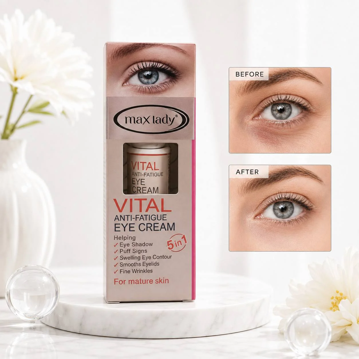 کرم دور چشم ضد خستگی 5 در 1 مکس لیدی مدل Vital - تصویر 2